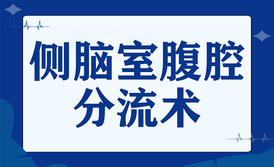 解决脑积水问题的有效方法 —— 侧脑室腹腔分流术